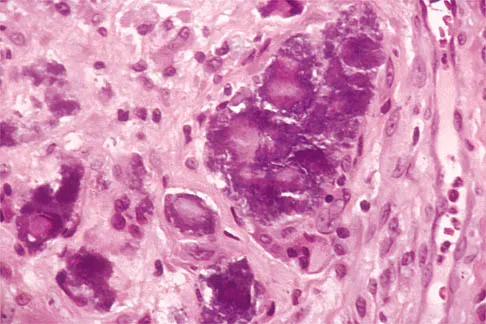 Shoulder 2026 MCQs: Board Review Questions & Answers (Part 1) - Figure 101