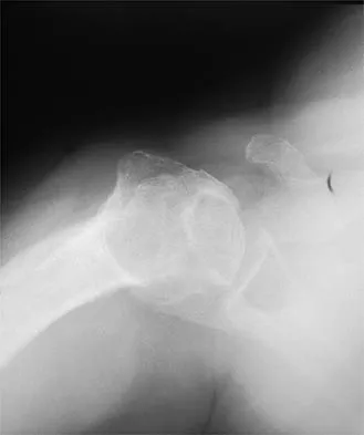 Shoulder 2026 MCQs: Board Review Questions & Answers (Part 1) - Figure 13