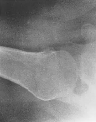 Shoulder 2026 MCQs: Board Review Questions & Answers (Part 1) - Figure 19