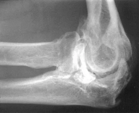 Shoulder 2026 MCQs: Board Review Questions & Answers (Part 1) - Figure 45