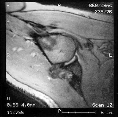 Shoulder 2026 MCQs: Board Review Questions & Answers (Part 1) - Figure 5