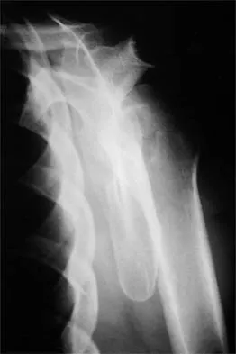 Shoulder 2026 MCQs: Board Review Questions & Answers (Part 1) - Figure 63