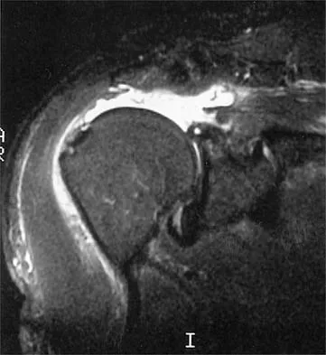 Shoulder 2026 MCQs: Board Review Questions & Answers (Part 1) - Figure 67