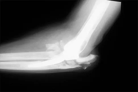 Shoulder 2026 MCQs: Board Review Questions & Answers (Part 1) - Figure 69