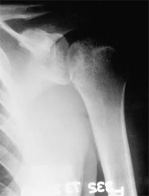 Shoulder 2026 MCQs: Board Review Questions & Answers (Part 2) - Figure 1