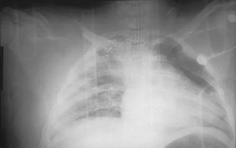 Shoulder 2026 MCQs: Board Review Questions & Answers (Part 2) - Figure 107