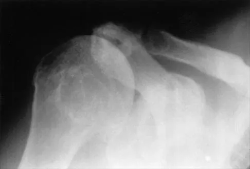 Shoulder 2026 MCQs: Board Review Questions & Answers (Part 2) - Figure 13