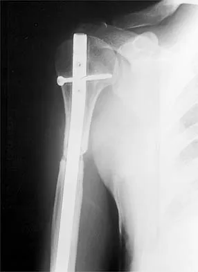 Shoulder 2026 MCQs: Board Review Questions & Answers (Part 2) - Figure 21