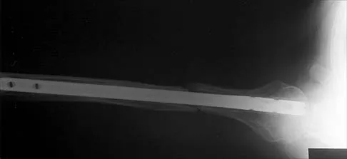 Shoulder 2026 MCQs: Board Review Questions & Answers (Part 2) - Figure 23