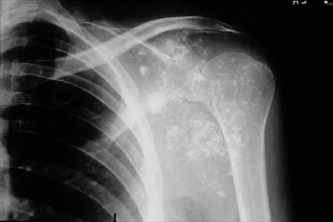 Shoulder 2026 MCQs: Board Review Questions & Answers (Part 2) - Figure 29