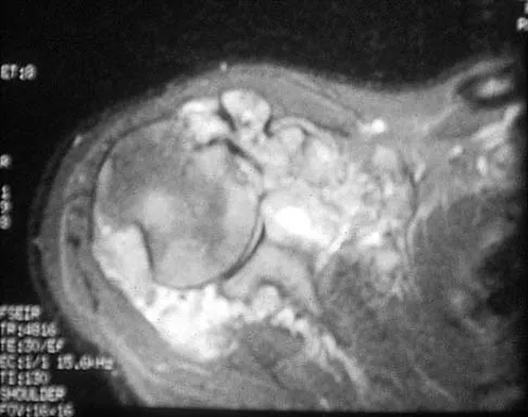 Shoulder 2026 MCQs: Board Review Questions & Answers (Part 2) - Figure 31