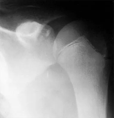 Shoulder 2026 MCQs: Board Review Questions & Answers (Part 2) - Figure 41