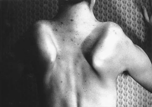 Shoulder 2026 MCQs: Board Review Questions & Answers (Part 2) - Figure 5