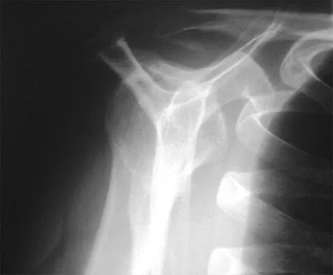 Shoulder 2026 MCQs: Board Review Questions & Answers (Part 2) - Figure 55