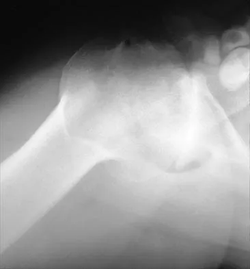 Shoulder 2026 MCQs: Board Review Questions & Answers (Part 2) - Figure 67