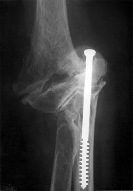 Shoulder 2026 MCQs: Board Review Questions & Answers (Part 2) - Figure 83