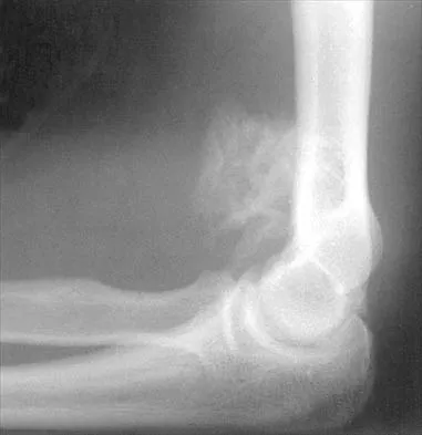 Shoulder 2026 MCQs: Board Review Questions & Answers (Part 2) - Figure 9