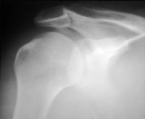 Shoulder 2026 MCQs: Board Review Questions & Answers (Part 3) - Figure 27