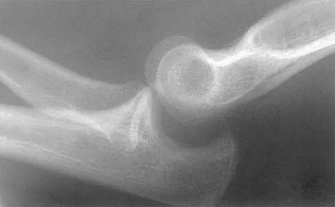 Shoulder 2026 MCQs: Board Review Questions & Answers (Part 3) - Figure 41