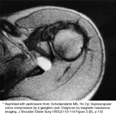 Shoulder 2026 MCQs: Board Review Questions & Answers (Part 3) - Figure 5