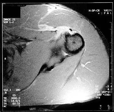 Shoulder 2026 MCQs: Board Review Questions & Answers (Part 3) - Figure 9