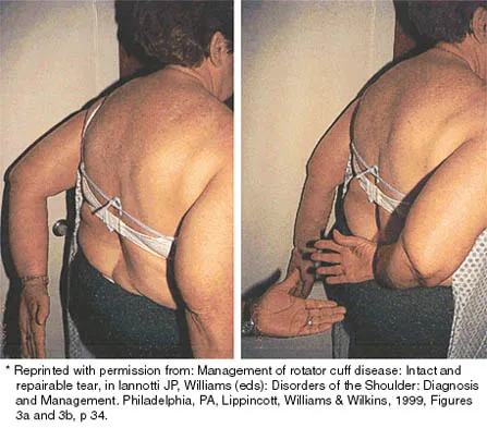Shoulder 2026 MCQs: Board Review Questions & Answers (Part 4) - Figure 15