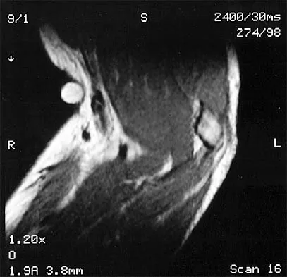 Shoulder 2026 MCQs: Board Review Questions & Answers (Part 4) - Figure 17