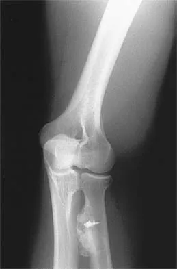 Shoulder 2026 MCQs: Board Review Questions & Answers (Part 4) - Figure 27