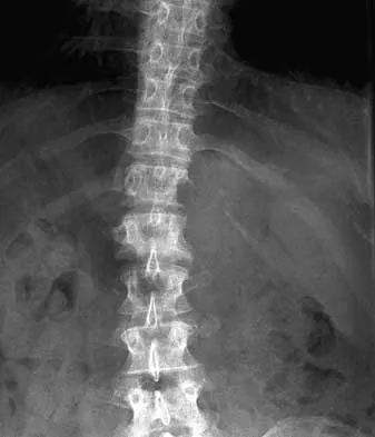 Spine 2026 MCQs: Board Review Questions & Answers (Part 1) - Figure 103