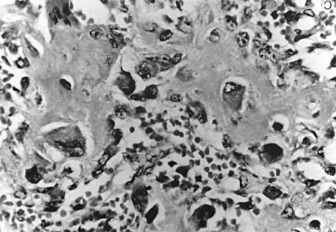 Spine 2026 MCQs: Board Review Questions & Answers (Part 1) - Figure 111