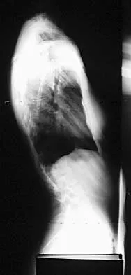 Spine 2026 MCQs: Board Review Questions & Answers (Part 1) - Figure 121