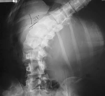 Spine 2026 MCQs: Board Review Questions & Answers (Part 1) - Figure 127