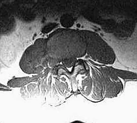 Spine 2026 MCQs: Board Review Questions & Answers (Part 1) - Figure 133