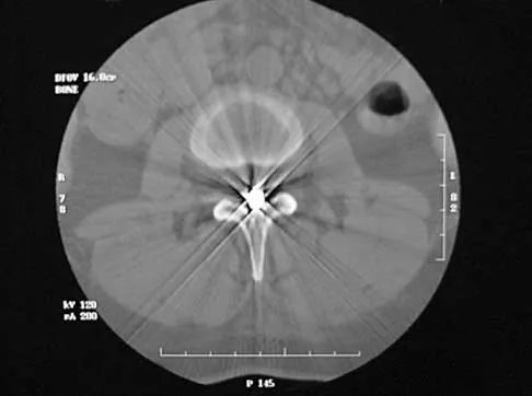 Spine 2026 MCQs: Board Review Questions & Answers (Part 1) - Figure 17