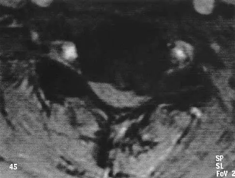 Spine 2026 MCQs: Board Review Questions & Answers (Part 1) - Figure 99