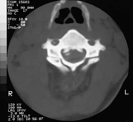 Spine 2026 MCQs: Board Review Questions & Answers (Part 2) - Figure 12