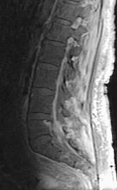 Spine 2026 MCQs: Board Review Questions & Answers (Part 2) - Figure 22