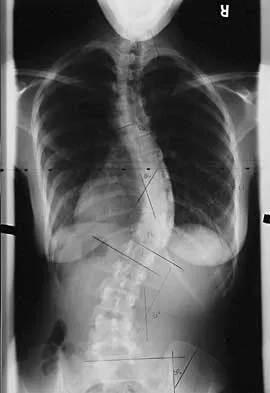 Spine 2026 MCQs: Board Review Questions & Answers (Part 2) - Figure 52