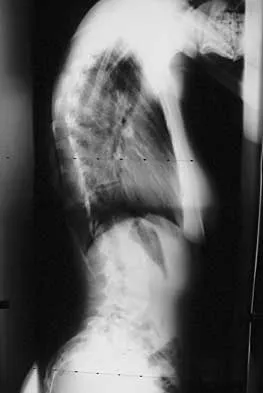 Spine 2026 MCQs: Board Review Questions & Answers (Part 2) - Figure 54