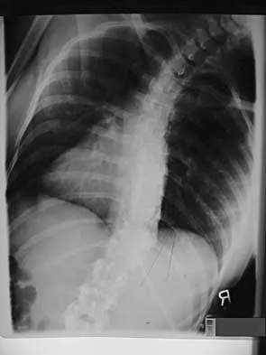 Spine 2026 MCQs: Board Review Questions & Answers (Part 2) - Figure 56