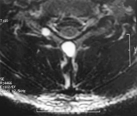 Spine 2026 MCQs: Board Review Questions & Answers (Part 2) - Figure 74