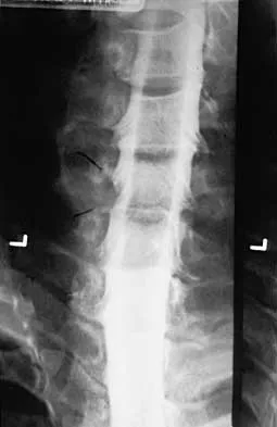 Spine 2026 MCQs: Board Review Questions & Answers (Part 2) - Figure 82