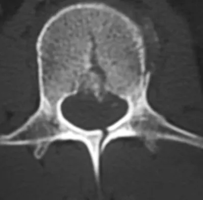 Spine 2026 MCQs: Board Review Questions & Answers (Part 2) - Figure 89
