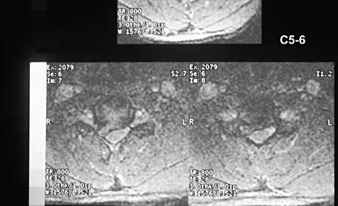 Spine 2026 MCQs: Board Review Questions & Answers (Part 2) - Figure 9