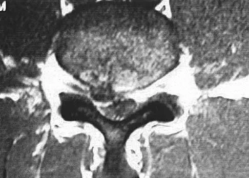 Spine 2026 MCQs: Board Review Questions & Answers (Part 3) - Figure 21