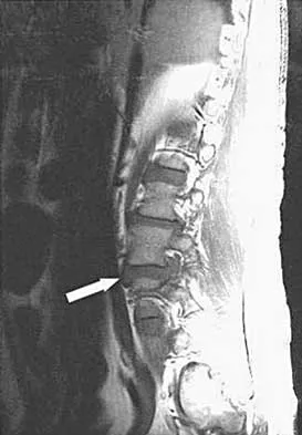 Spine 2026 MCQs: Board Review Questions & Answers (Part 3) - Figure 3