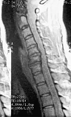 Spine 2026 MCQs: Board Review Questions & Answers (Part 3) - Figure 33