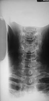 Spine 2026 MCQs: Board Review Questions & Answers (Part 4) - Figure 21