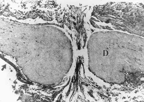Spine 2026 MCQs: Board Review Questions & Answers (Part 4) - Figure 30