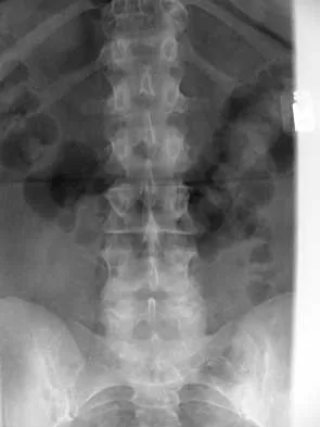 Spine 2000 MCQs - Part 1